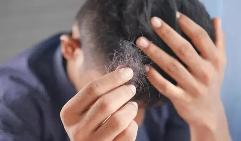 آیا مکمل‌های گیاهی می‌توانند به درمان ریزش مو کمک کنند؟