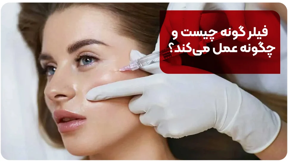 فیلر گونه چیست و چگونه عمل میکند؟