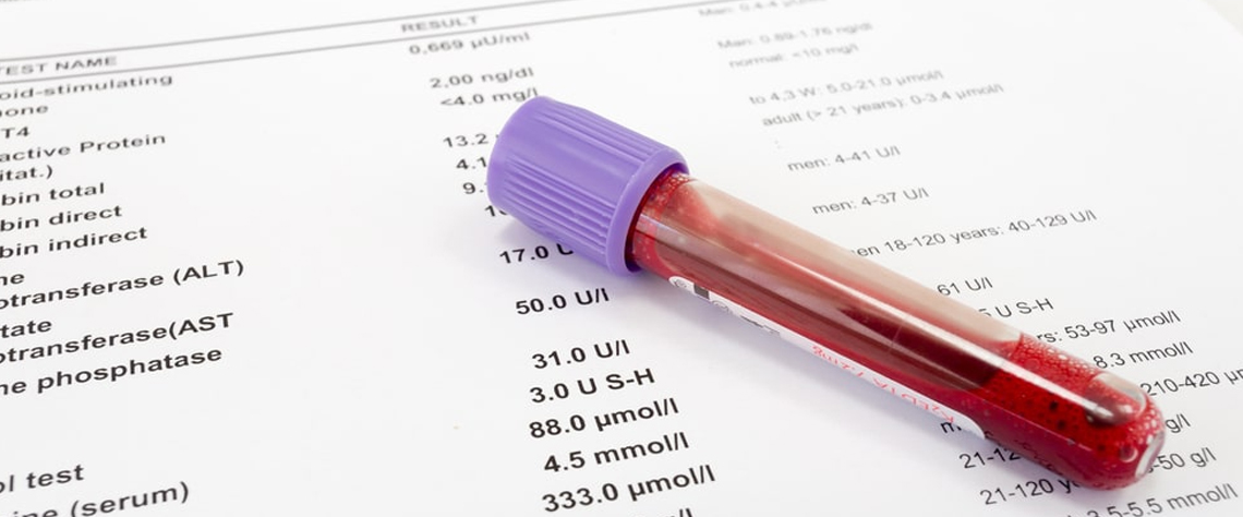 مراقبت پس از دریافت نتایج